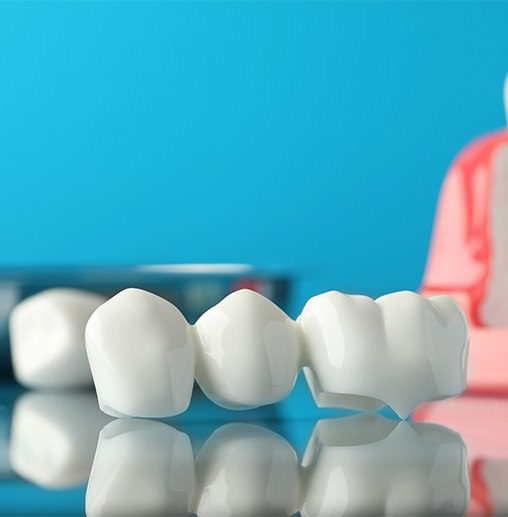 Dental bridge and sample implant on a reflective surface with light blue background