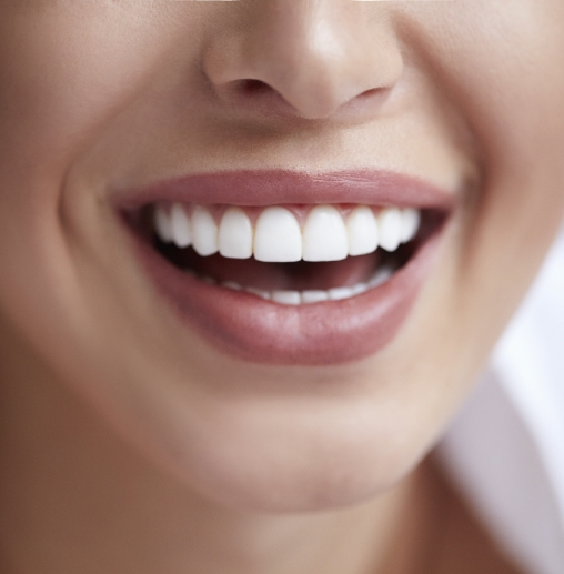 Close up of smile with flawless teeth